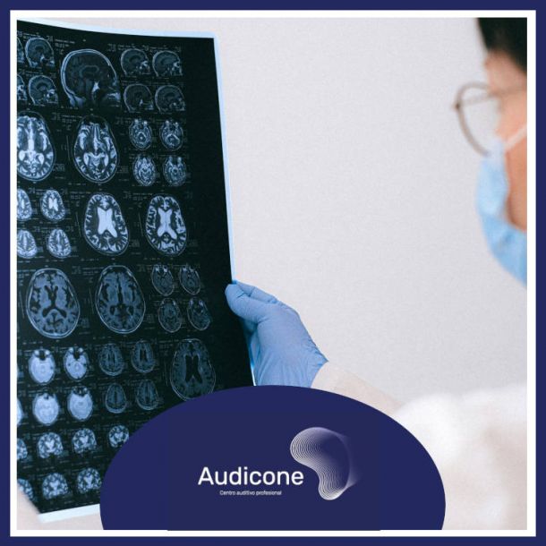 El Día del Cerebro y su relación con la audición